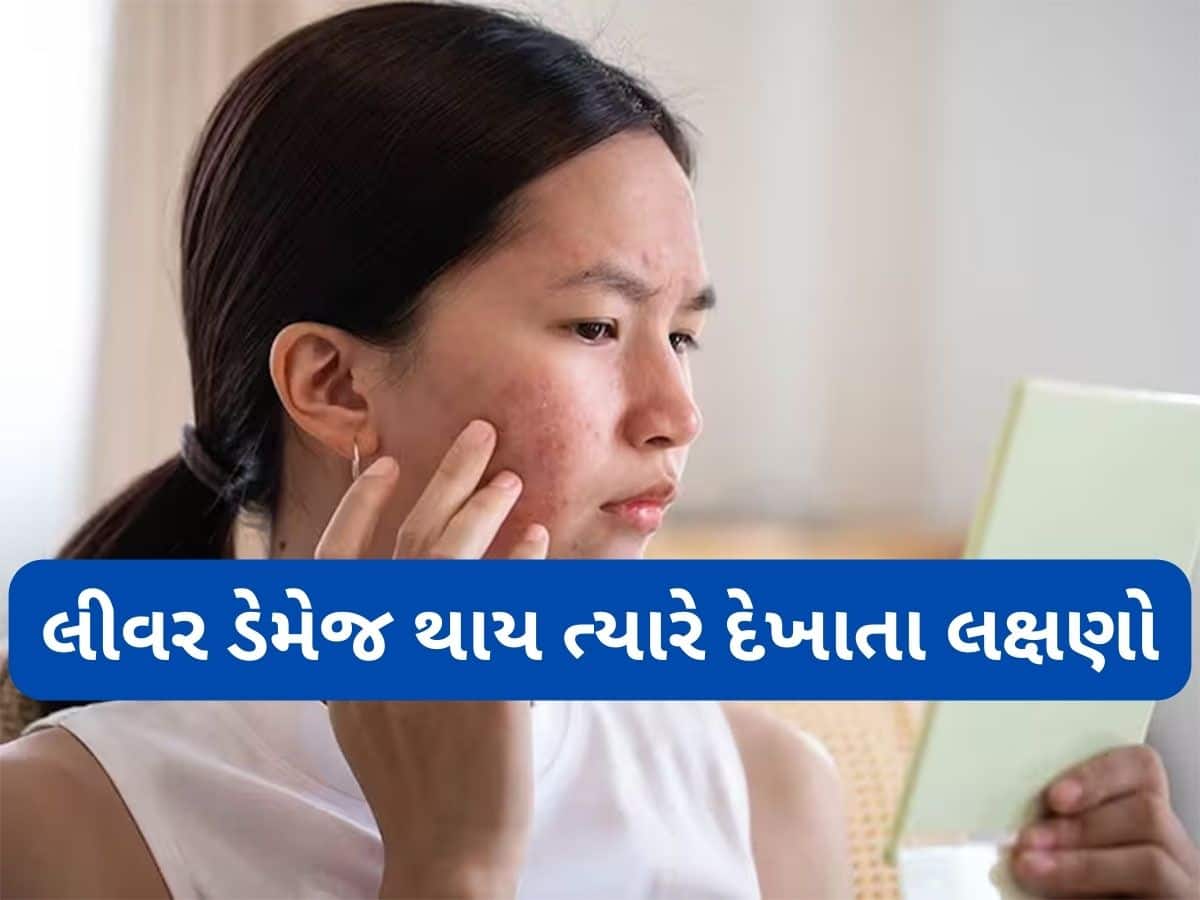 Liver Damage: લિવર ડેમેજ થાય ત્યારે ચહેરા પર દેખાય છે આ 4 લક્ષણો, આ સ્કિન પ્રોબ્લેમ ને ઈગ્નોર ન કરો