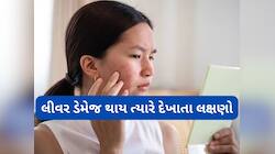 લિવર ડેમેજ થાય ત્યારે ચહેરા પર દેખાય છે આ 4 લક્ષણો, આ સ્કિન પ્રોબ્લેમ ઈગ્નોર ન કરો