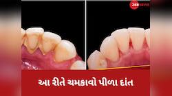 ગુટકા-પાન ખાઈને ગંદા પીળા થઈ ગયા છે દાંત? ચમકાવવા માટે અજમાવો આ ઘરગથ્થું ઉપાય