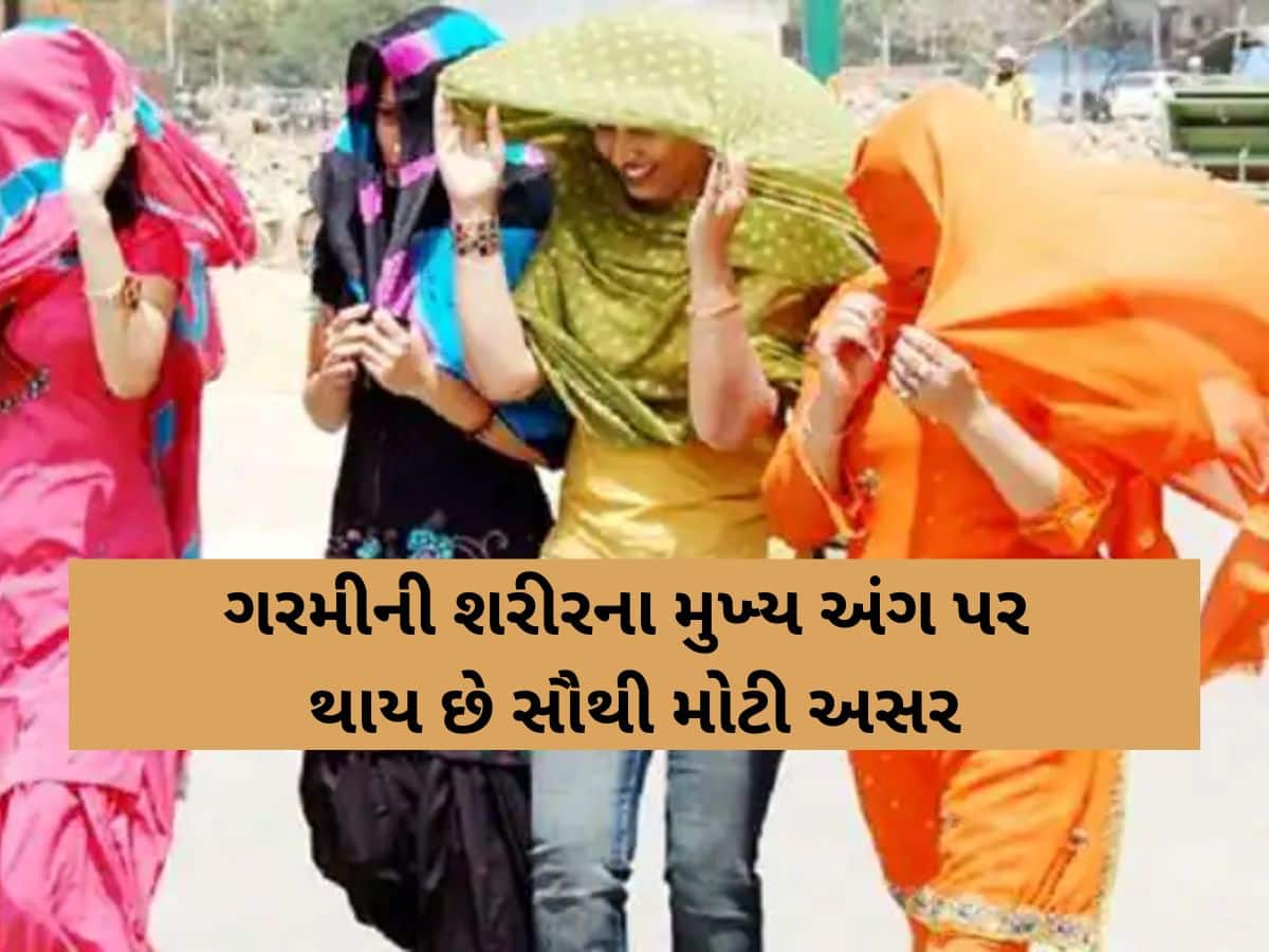 અમદાવાદીઓ સાવધાન! કાળઝાળ ગરમીમાં શરીરના મુખ્ય અંગ પર અસર; કેસમાં 20 ટકાનો વધારો!