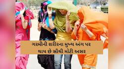 અમદાવાદીઓ સાવધાન! કાળઝાળ ગરમીમાં શરીરના મુખ્ય અંગ પર અસર; કેસમાં 20 ટકાનો વધારો!