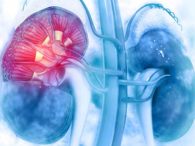 Kidney Disease | Kidney Problem | આ 5 લોકોમાં કિડની ડેમેજ થવાનો રહે છે ...