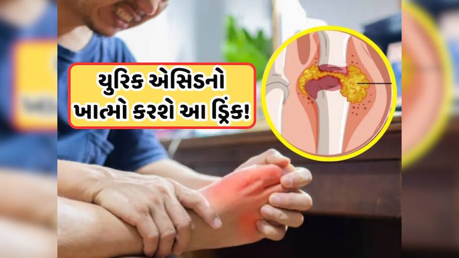 Health Tips: ખાલી પેટ પીઓ આ રસોડાના મસાલાનું પાણી, 21 દિવસમાં યુરિક એસિડ થશે દૂર!