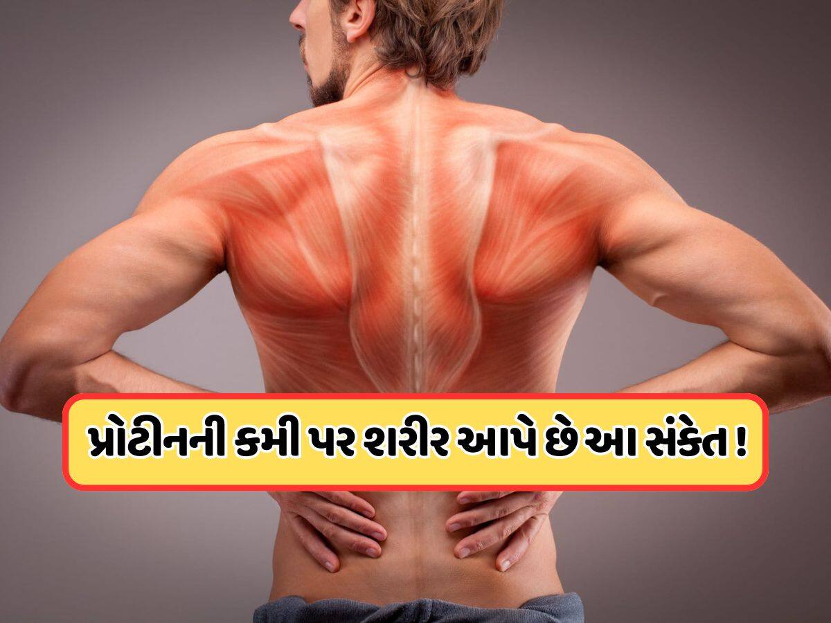 શરીરમાં ઘટી રહ્યું છે પ્રોટીનનું લેવલ, સ્નાયુ તૂટતા પહેલા આ સંકેતોને ઓળખો