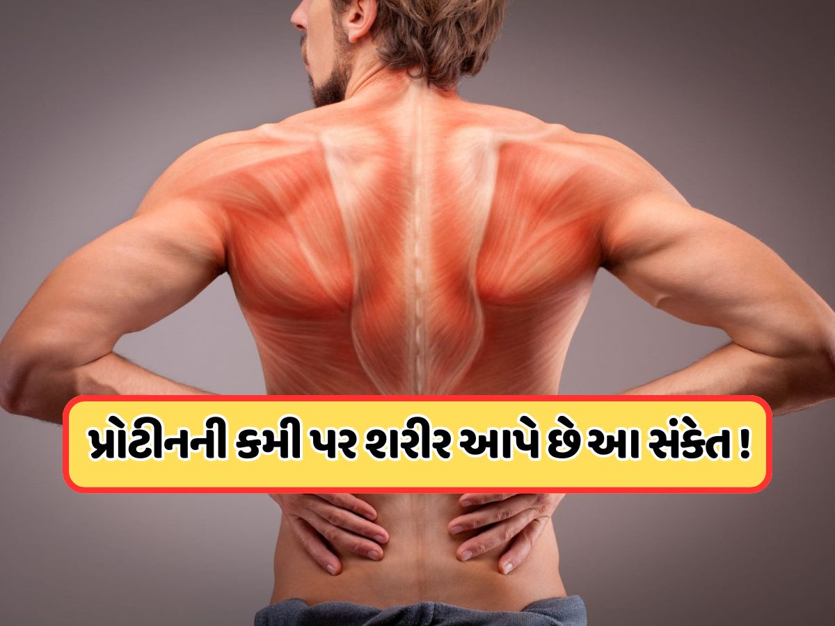 શરીરમાં ઘટી રહ્યું છે પ્રોટીનનું લેવલ, સ્નાયુ તૂટતા પહેલા આ સંકેતોને ઓળખો શરીરમાં ઘટી રહ્યું છે પ્રોટીનનું લેવલ, સ્નાયુ તૂટતા પહેલા આ સંકેતોને ઓળખો