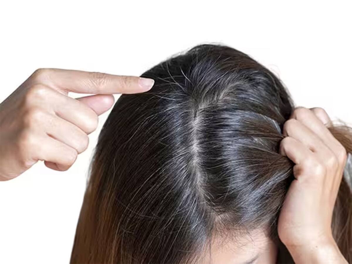 White Hair: 3 નેચરલ વસ્તુથી બનાવો નેચરલ હેર કલર, માથામાં લગાડતાં જ સફેદ વાળ મૂળમાંથી કાળા થઈ જશે 