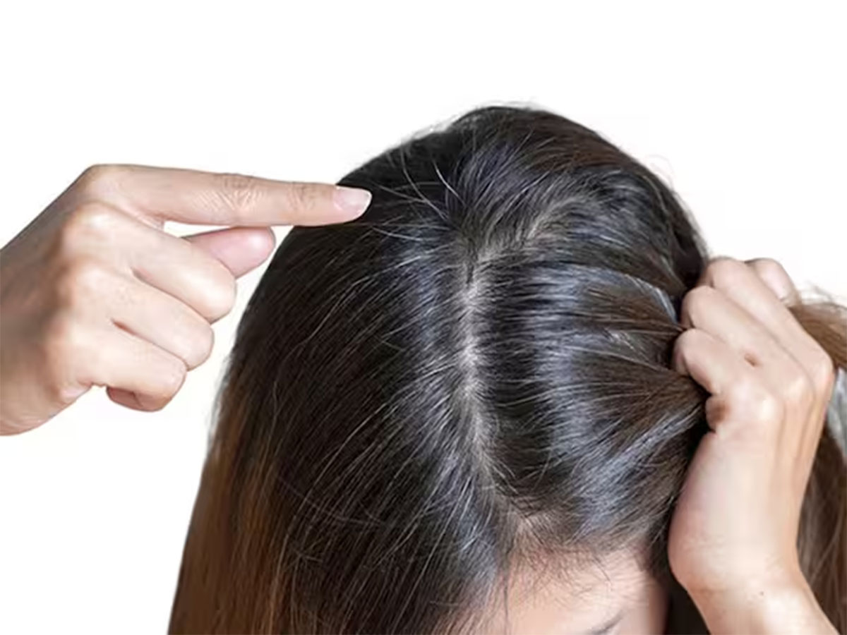White Hair: 3 નેચરલ વસ્તુથી બનાવો નેચરલ હેર કલર, માથામાં લગાડતાં જ સફેદ વાળ મૂળમાંથી કાળા થઈ જશે