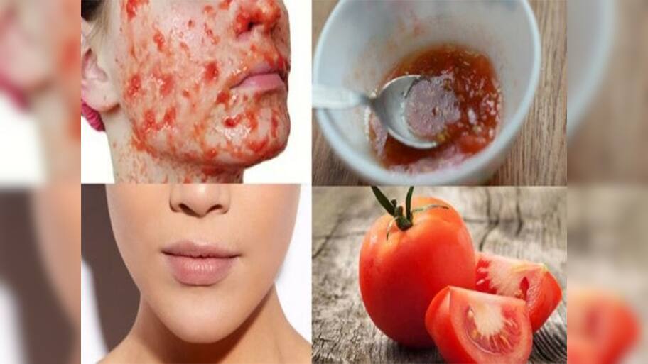Tanning Removal: તડકાના કારણે થયેલું ટેનિંગ સાફ કરવા ટમેટામાં આ 2 વસ્તુ મિક્સ કરી લગાડો, 10 મિનિટમાં ત્વચા રુપાળી થઈ જશે