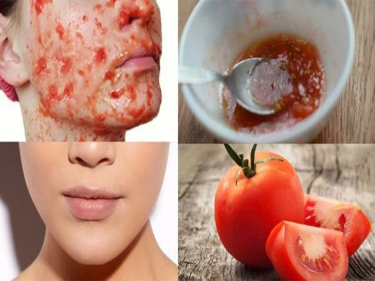 Tanning Removal: તડકાના કારણે થયેલું ટેનિંગ સાફ કરવા ટમેટામાં આ 2 વસ્તુ મિક્સ કરી લગાડો, 10 મિનિટમાં ત્વચા રુપાળી થઈ જશે Tanning Removal: તડકાના કારણે થયેલું ટેનિંગ સાફ કરવા ટમેટામાં આ 2 વસ્તુ મિક્સ કરી લગાડો, 10 મિનિટમાં ત્વચા રુપાળી થઈ જશે