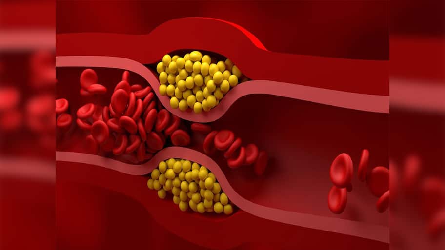 Bad Cholesterol: બેડ કોલેસ્ટ્રોલનો સફાયો કરી નાખશે આ પેસ્ટ, રોજ સવારે 1 ચમચી હુંફાળા પાણી સાથે ખાવી