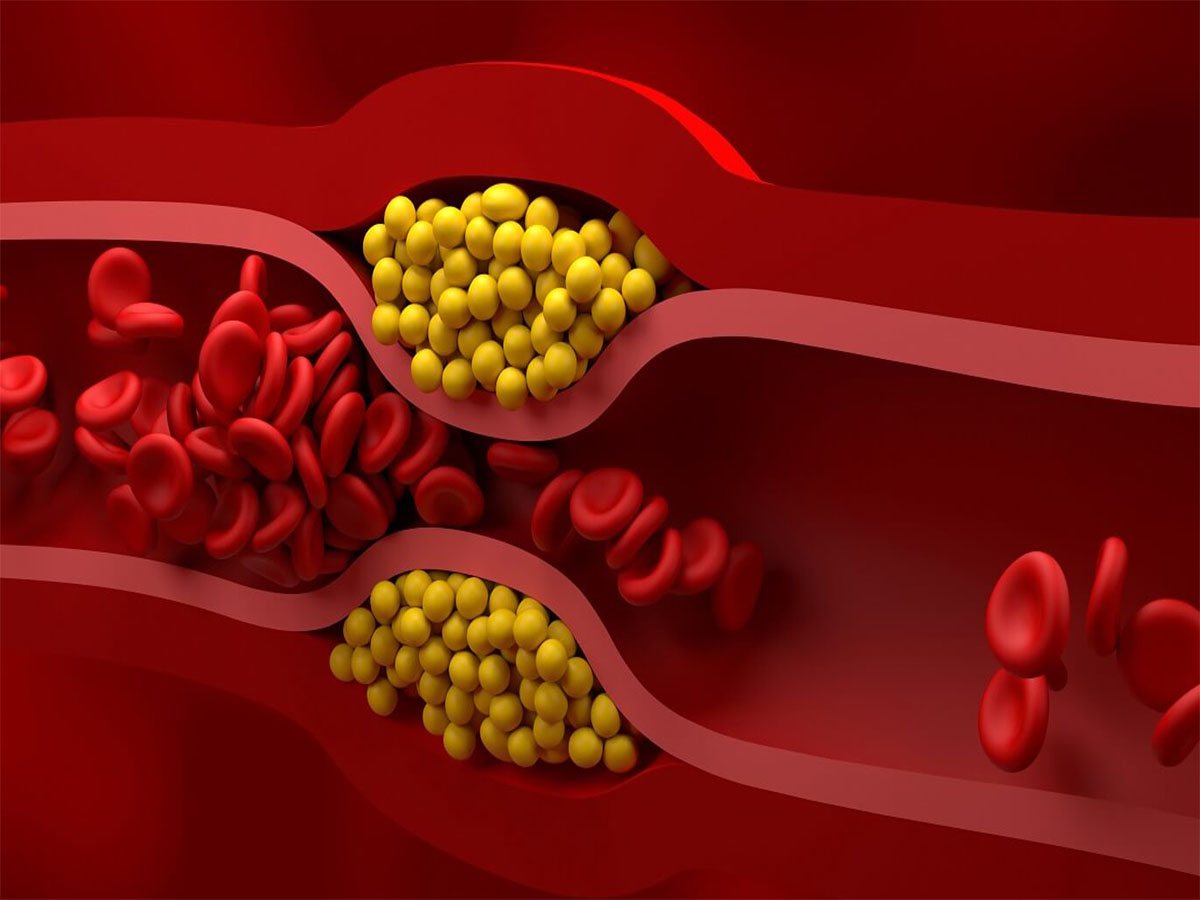 Bad Cholesterol: બેડ કોલેસ્ટ્રોલનો સફાયો કરી નાખશે આ પેસ્ટ, રોજ સવારે 1 ચમચી હુંફાળા પાણી સાથે ખાવી Bad Cholesterol: બેડ કોલેસ્ટ્રોલનો સફાયો કરી નાખશે આ પેસ્ટ, રોજ સવારે 1 ચમચી હુંફાળા પાણી સાથે ખાવી