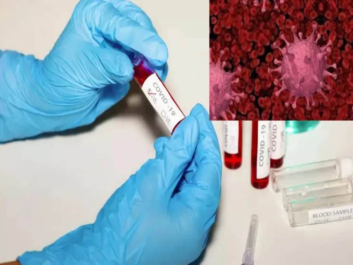 COVID-19 Case: દેશમાં કોરોનાએ રોકેટગતિએ સ્પીડ પકડી, ગુજરાત-દિલ્હી સહિત અન્ય રાજ્યોમાં કેવી છે સ્થિતિ?