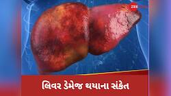 સવારે ઉઠીને મળ ત્યાગ વખતે જોવા મળે છે લિવર ડેમેજના આ લક્ષણ, ભૂલેચૂકે નજરઅંદાજ ન કરતા