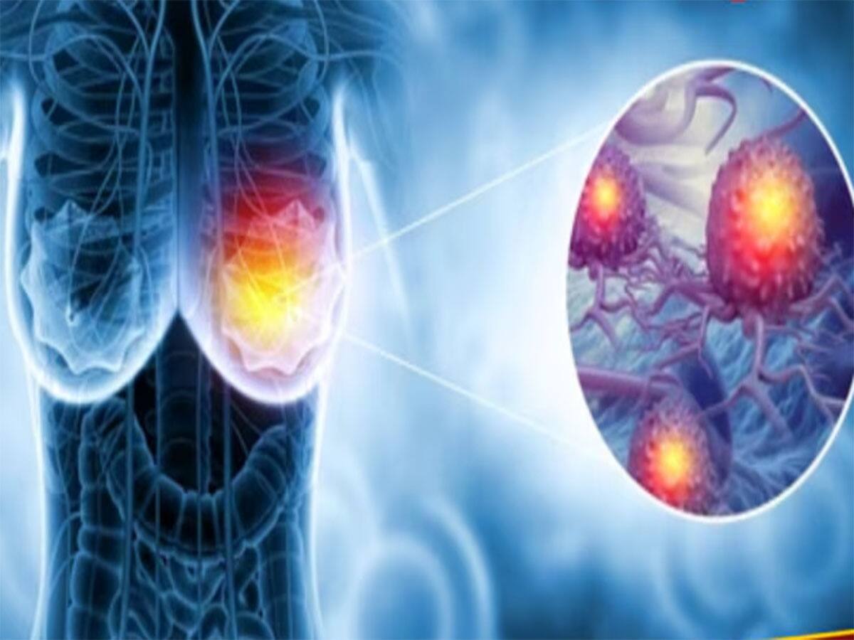 Breast Cancer: બ્રેસ્ટ કેન્સરનું જોખમ ઘટાડે છે આ 5 ફૂડ, એક્સપર્ટ કહે છે મહિલાઓએ રોજ ખાવા જોઈએ