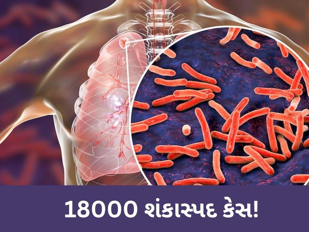   બનાસકાંઠા જિલ્લાના 186 ગામડાઓમાં અચાનક વધી ગયા આ બીમારીના કેસ, 478 દર્દીઓ પોઝિટિવ