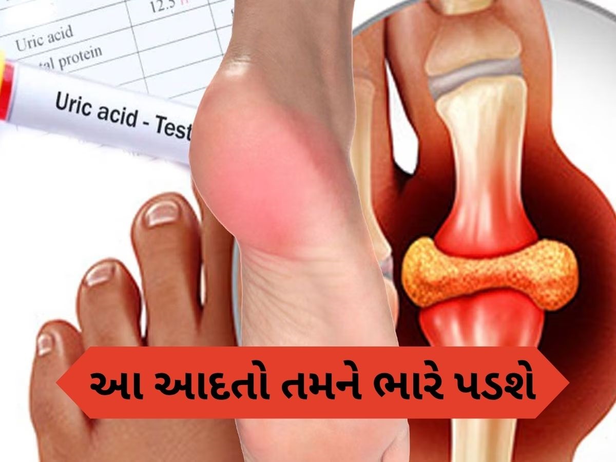 યુરિક એસિડની સમસ્યા અચાનક વધારી દેશે આ 5 આદતો, નબળા પડી જશે મજબૂત હાડકા