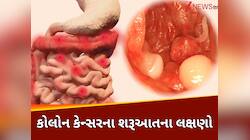 કોઈ કારણ વગર ઝડપી ઘટી રહ્યું છે વજન તો થઈ જાવ સાવધાન,કોલોન કેન્સરનો હોય શકે છે સંકેત