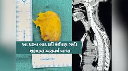 આ 'દાદા'ને કેરીનો સ્વાદ ભારે પડ્યો! કેરીનો ગોટલો ગળી ગયા અને પછી થઈ જોવા જેવી...