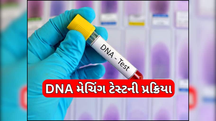 શું છે DNA મેચિંગ ટેસ્ટ? કેવી રીતે થાય છે સ્વજનોની ઓળખ? જાણો સમગ્ર પ્રક્રિયા અને કેટલો લાગે છે સમય