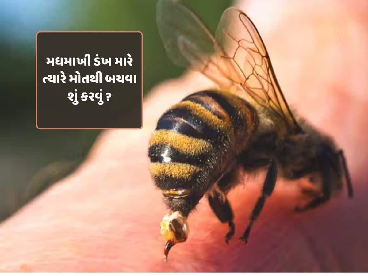 મધમાખીનો ડંખ માણસને મોતના મોંમાં ધકેલી શકે છે; જાણો આવી પરિસ્થિતિમાં બચવા શું કરવું...