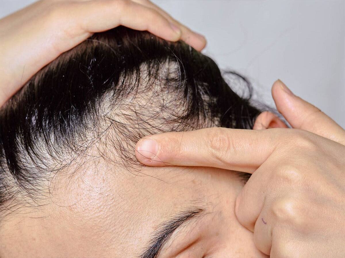 Hair Growth: થોડા દિવસ માટે વાળમાં રોજ લગાડો આ વસ્તુ, માથામાંથી ખરી ગયેલા વાળ 100 ની સ્પીડે પાછા ઉગવા લાગશે