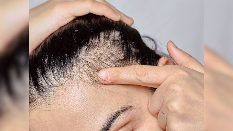 Hair Growth: થોડા દિવસ માટે વાળમાં રોજ લગાડો આ વસ્તુ, માથામાંથી ખરી ગયેલા વાળ 100 ની સ્પીડે પાછા ઉગવા લાગશે