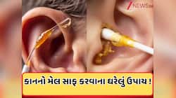 કાનની અંદર જામેલી ગંદકી ખેંચીને બહાર કાઢશે આ રામબાણ ઉપાય! જાણો ઘરેલું ઉપાય