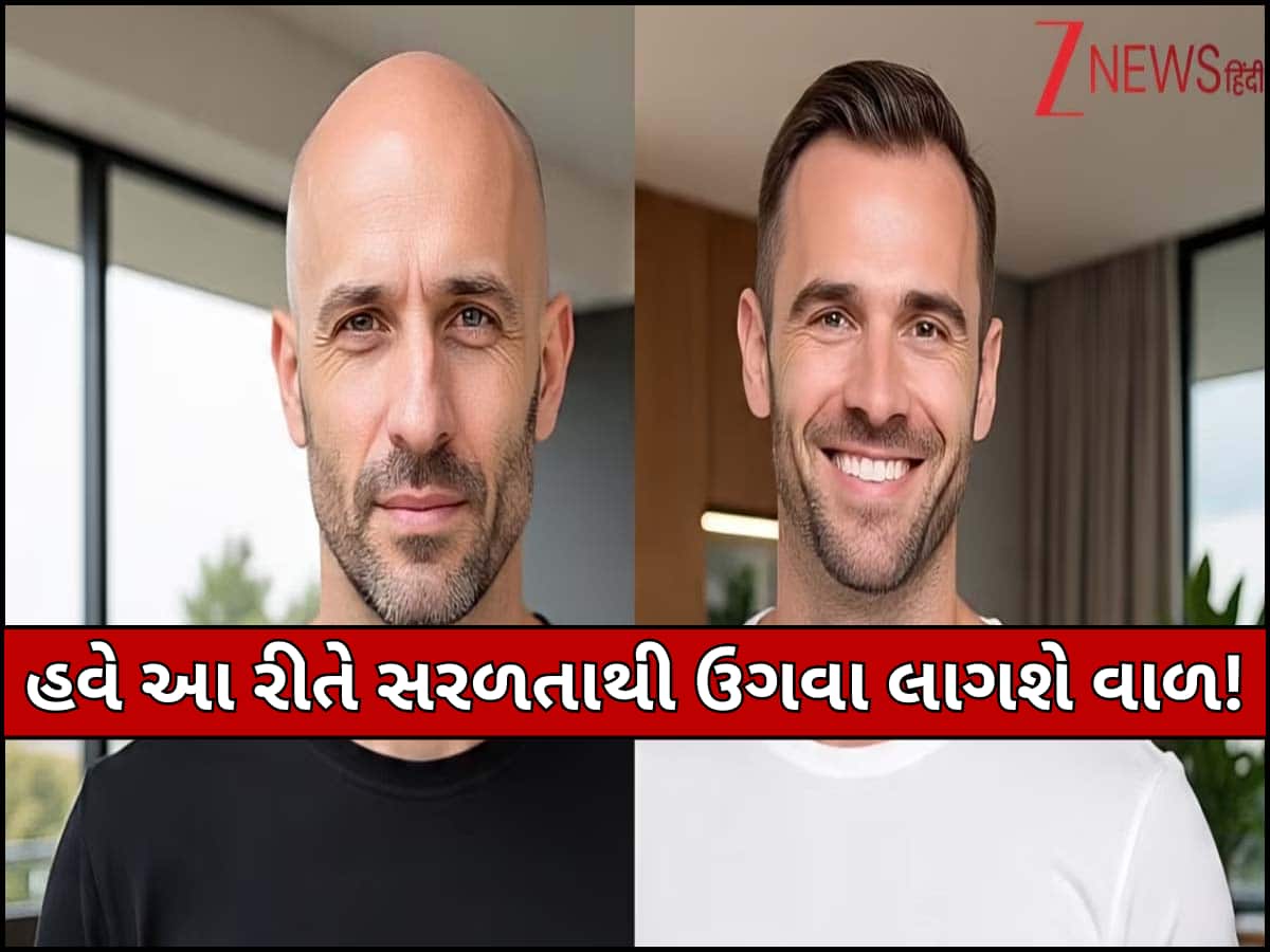 હવે ટાલિયાપણાથી મળશે છૂટકારો! વૈજ્ઞાનિકોએ વાળને ફરીથી ઉગાડવાની કરી સરળ શોધ, જલ્દી બજારમાં આવશે નવી ટ્રીટમેન્ટ