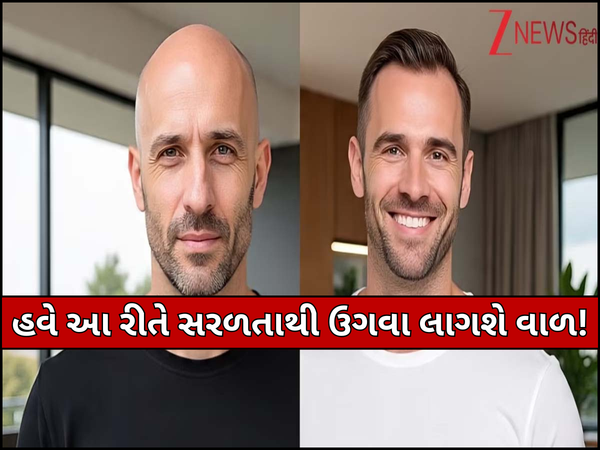 હવે ટાલિયાપણાથી મળશે છૂટકારો! વૈજ્ઞાનિકોએ વાળને ફરીથી ઉગાડવાની કરી સરળ શોધ, જલ્દી બજારમાં આવશે નવી ટ્રીટમેન્ટ હવે ટાલિયાપણાથી મળશે છૂટકારો! વૈજ્ઞાનિકોએ વાળને ફરીથી ઉગાડવાની કરી સરળ શોધ, જલ્દી બજારમાં આવશે નવી ટ્રીટમેન્ટ