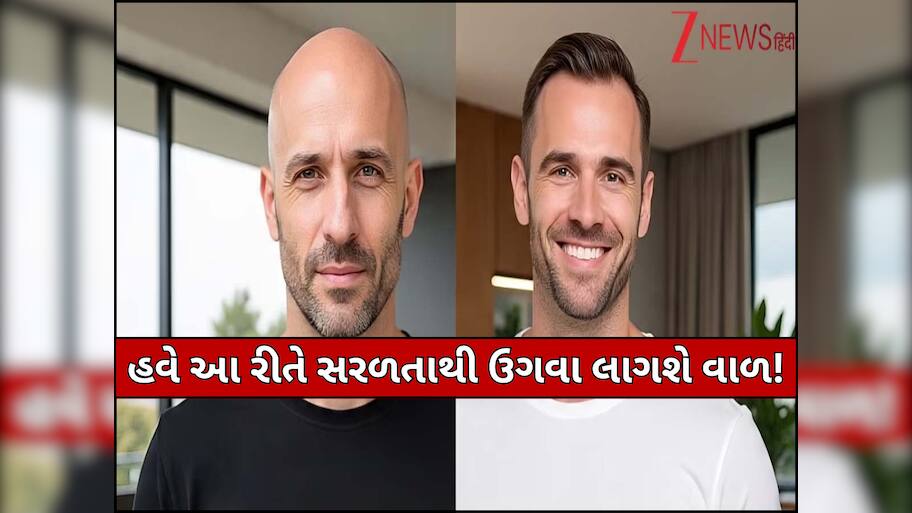 હવે ટાલિયાપણાથી મળશે છૂટકારો! વૈજ્ઞાનિકોએ વાળને ફરીથી ઉગાડવાની કરી સરળ શોધ, જલ્દી બજારમાં આવશે નવી ટ્રીટમેન્ટ