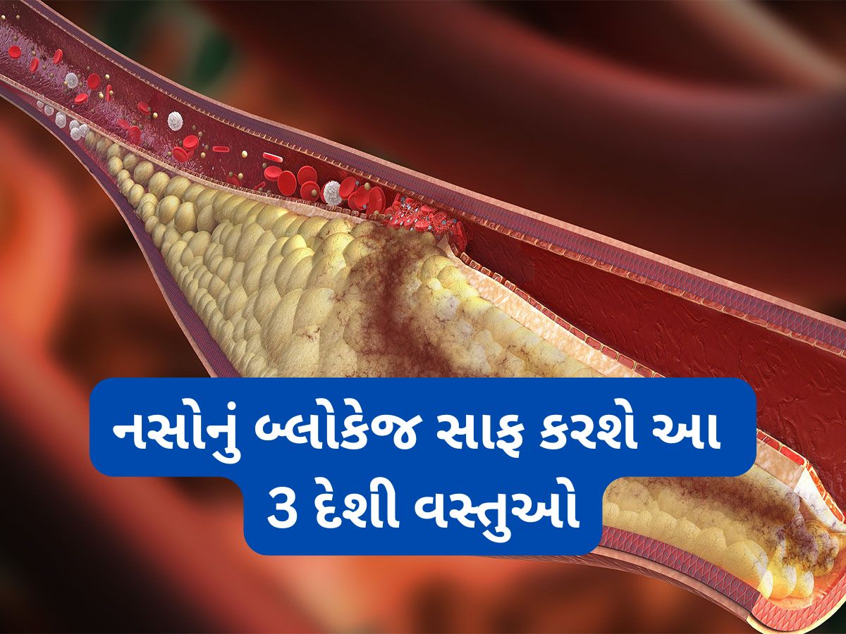 Bad Cholesterol: શરીરમાં કોલેસ્ટ્રોલ વધી ગયું હોય તો આ 3 વસ્તુ અજમાવો, નસોમાં જામેલું બ્લોકેજ ઝડપથી સાફ થશે