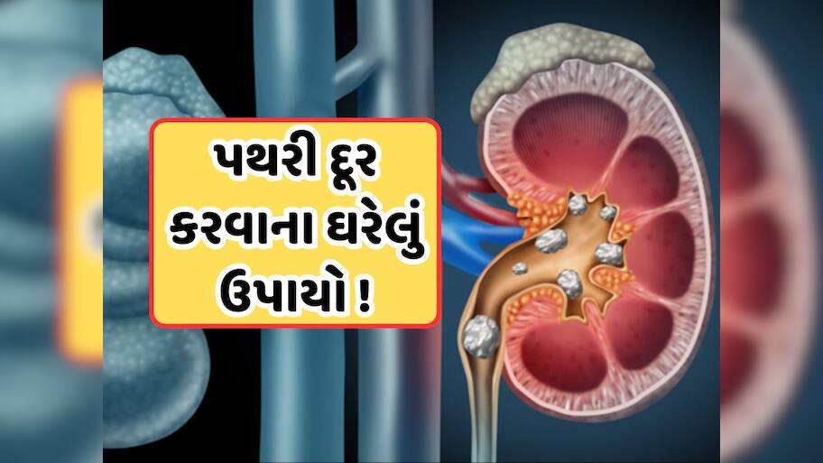 કિડનીમાં થયેલી પથરીને ચૂર-ચૂર કરી બહાર કાઢી નાખશે આ ચા, જાણો તેનું સેવન કેવી રીતે કરવું