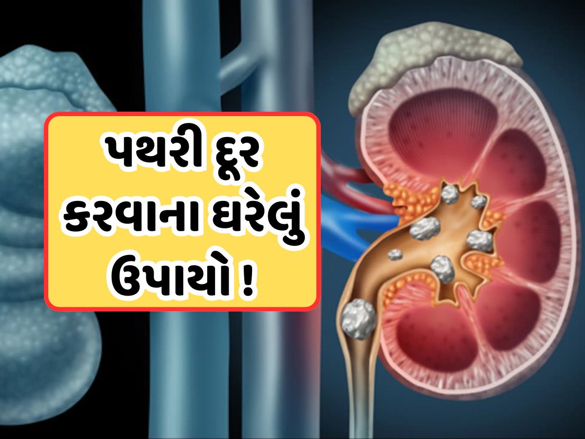 કિડનીમાં થયેલી પથરીને ચૂર-ચૂર કરી બહાર કાઢી નાખશે આ ચા, જાણો તેનું સેવન કેવી રીતે કરવું કિડનીમાં થયેલી પથરીને ચૂર-ચૂર કરી બહાર કાઢી નાખશે આ ચા, જાણો તેનું સેવન કેવી રીતે કરવું
