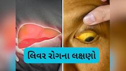 આ 6 લક્ષણ જણાવશે કે તમારૂ લિવર થઈ ગયું છે ખરાબ, નજરઅંદાજ કરશો તો ભારે પડશે
