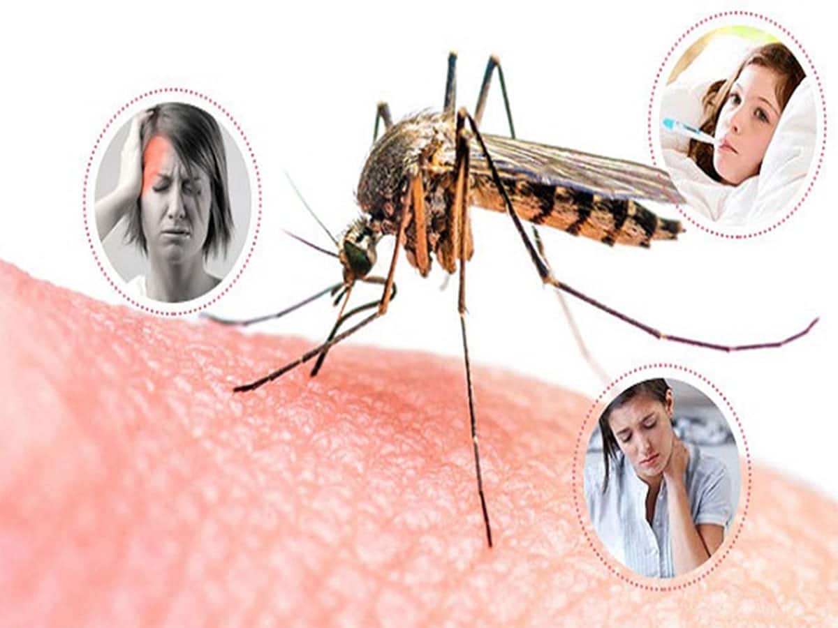 Health Tips: ડેન્ગ્યુ અને મલેરિયાના શરુઆતી લક્ષણો વિશે જાણો, એક પણ લક્ષણને ઈગ્નોર કરવાની ભુલ ન કરવી