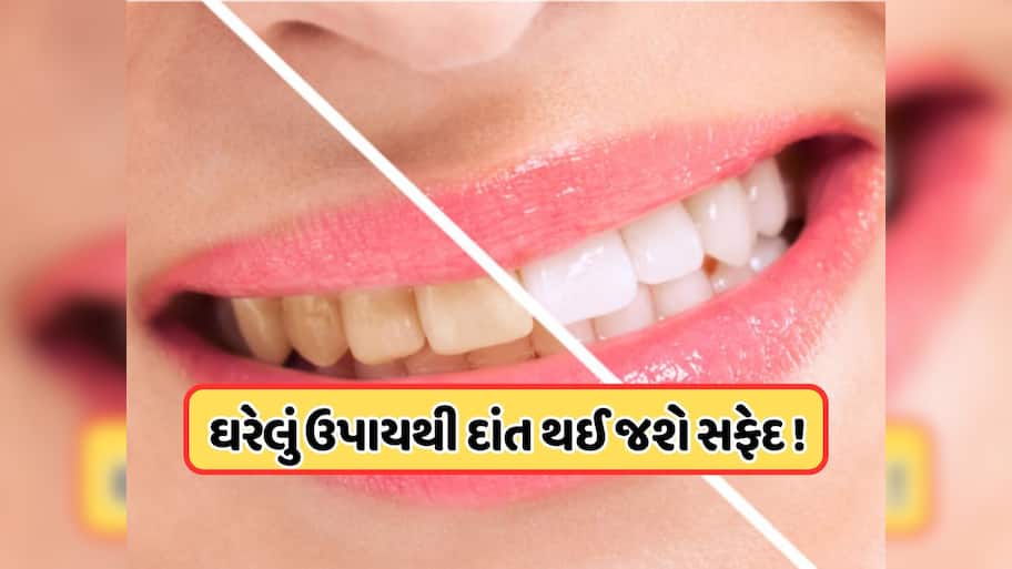 શું તમારા દાંત થઈ ગયા છે પીળા ? આ 2 વસ્તુઓ ઘસો, પીળી ગંદકી સાથે મોઢાની દુર્ગંધ પણ થઈ જશે દૂર !