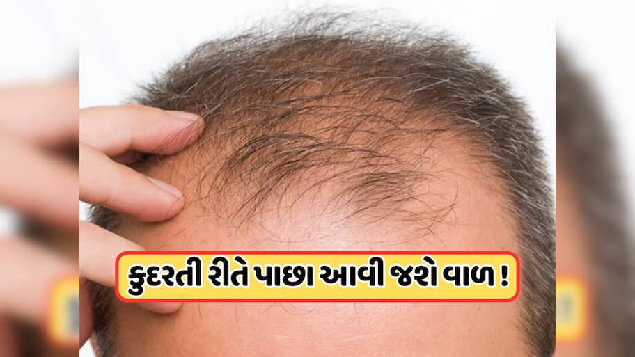 આ 5 આયુર્વેદિક ઉપાયો દ્વારા ફરીથી ઉગશે નવા વાળ, ટાલ થઈ જશે ગાયબ !