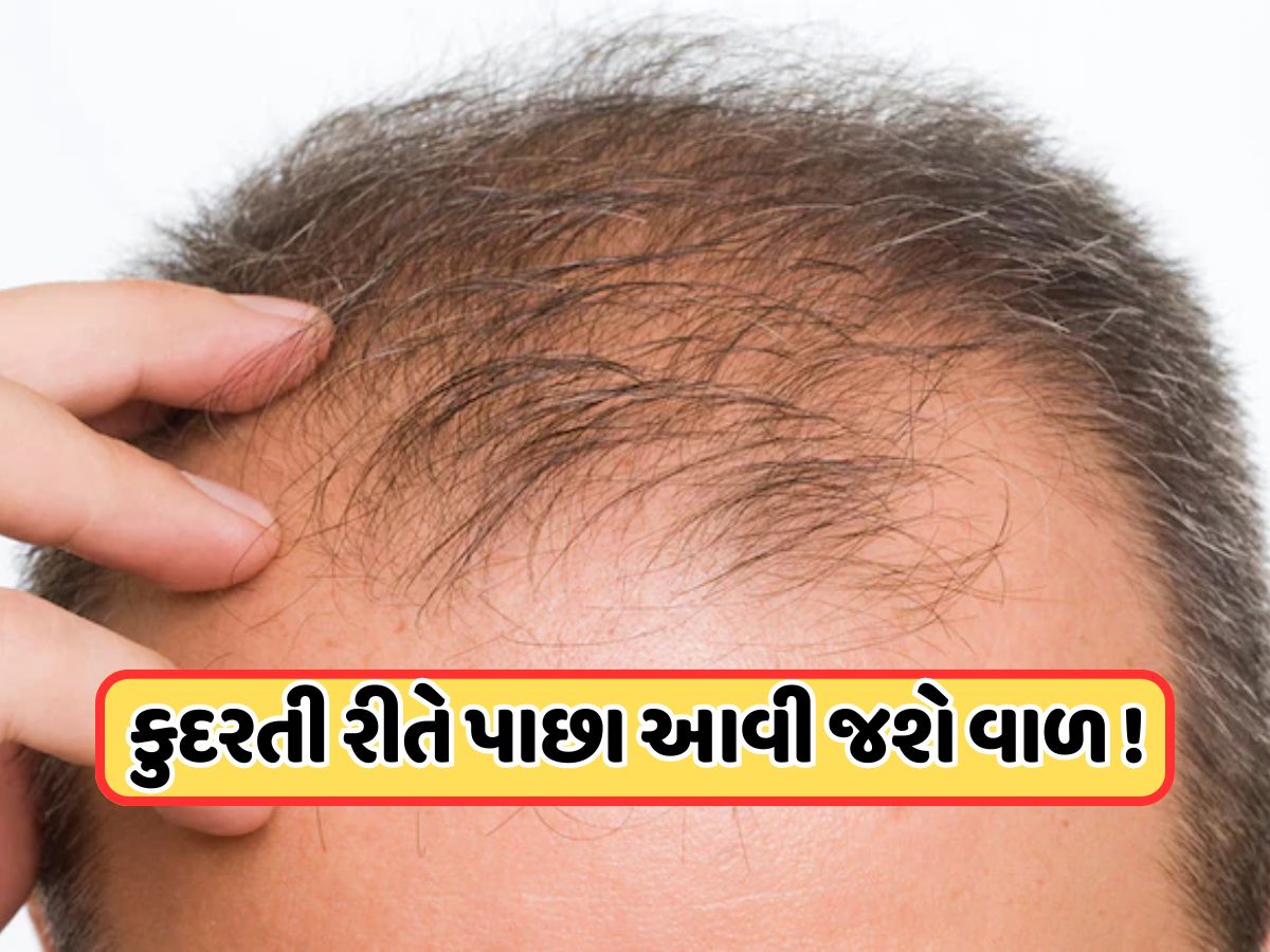 આ 5 આયુર્વેદિક ઉપાયો દ્વારા ફરીથી ઉગશે નવા વાળ, ટાલ થઈ જશે ગાયબ ! આ 5 આયુર્વેદિક ઉપાયો દ્વારા ફરીથી ઉગશે નવા વાળ, ટાલ થઈ જશે ગાયબ !