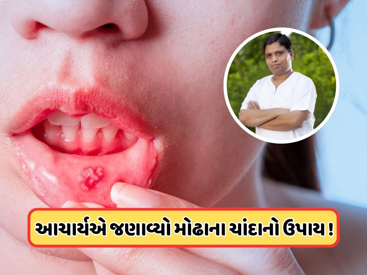 વારંવાર મોઢામાં પડે છે ચાંદા? આચાર્ય બાલકૃષ્ણએ કહ્યું કે આ પાંદડાના પાણીથી કરો કોગળા, તરત જ મળશે રાહત વારંવાર મોઢામાં પડે છે ચાંદા? આચાર્ય બાલકૃષ્ણએ કહ્યું કે આ પાંદડાના પાણીથી કરો કોગળા, તરત જ મળશે રાહત