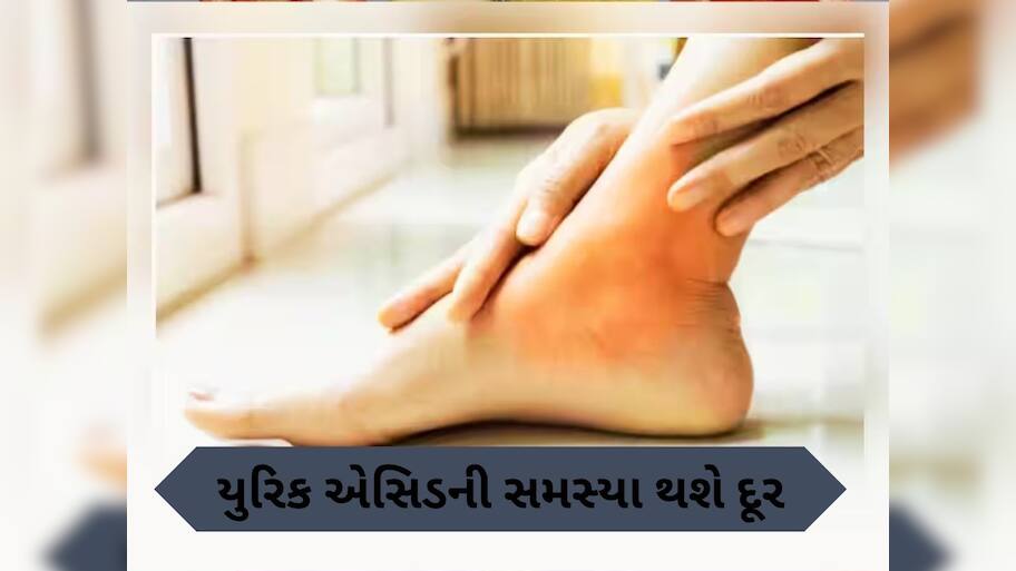  યુરિક એસિડને કારણે પગમાં થઈ રહ્યો છે દુખાવો, અપનાવો આ 5 ઘરેલું નુસ્ખા, જલ્દી મળશે રાહત