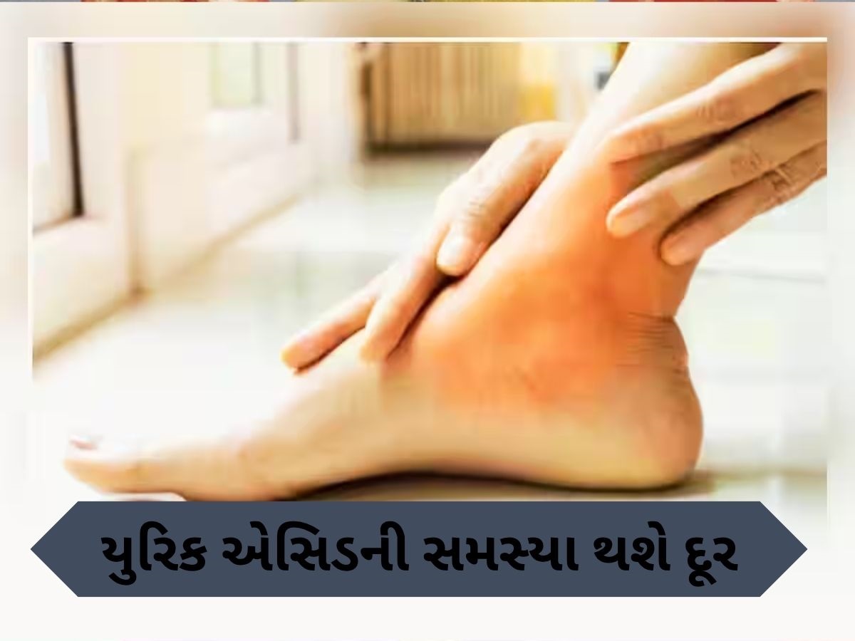 યુરિક એસિડને કારણે પગમાં થઈ રહ્યો છે દુખાવો, અપનાવો આ 5 ઘરેલું નુસ્ખા, જલ્દી મળશે રાહત યુરિક એસિડને કારણે પગમાં થઈ રહ્યો છે દુખાવો, અપનાવો આ 5 ઘરેલું નુસ્ખા, જલ્દી મળશે રાહત