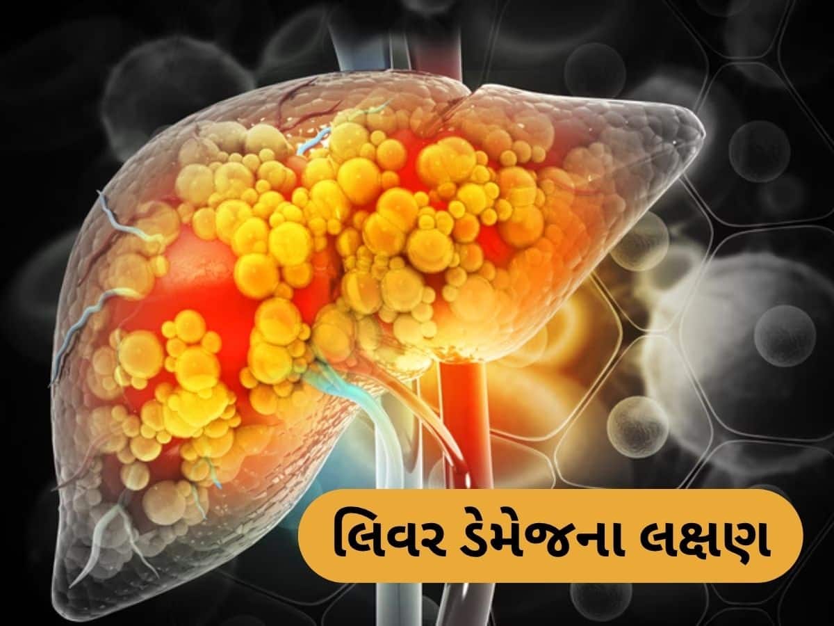 Liver Damage: લિવર ડેમેજનું સૌથી મોટું લક્ષણ, આ સમસ્યા થાય તો ડોક્ટરને જરૂર દેખાડો