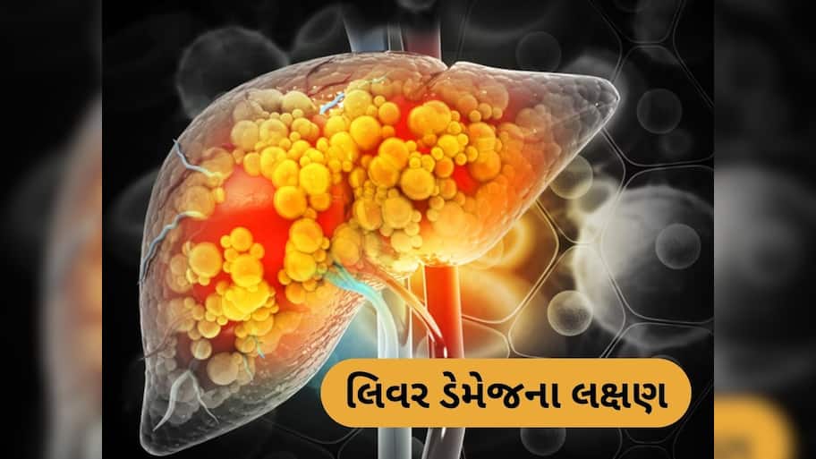 Liver Damage: લિવર ડેમેજનું સૌથી મોટું લક્ષણ, આ સમસ્યા થાય તો ડોક્ટરને જરૂર દેખાડો