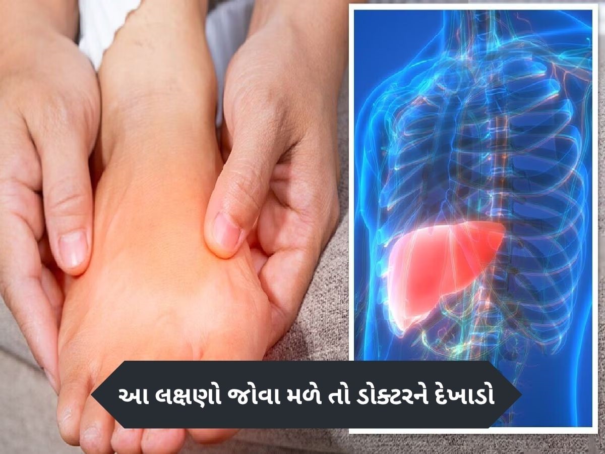 પગમાં અચાનક જોવા મળશે લિવર ખરાબના આ લક્ષણો, નજરઅંદાજ કરશો તો ભારે પડશે પગમાં અચાનક જોવા મળશે લિવર ખરાબના આ લક્ષણો, નજરઅંદાજ કરશો તો ભારે પડશે