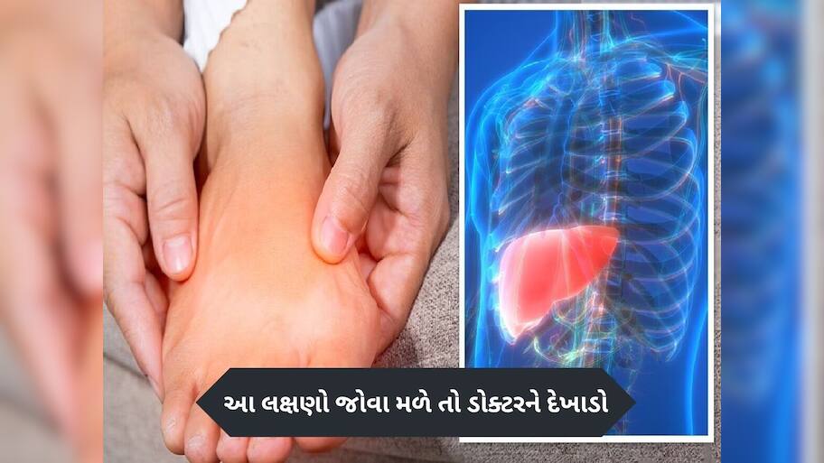  પગમાં અચાનક જોવા મળશે લિવર ખરાબના આ લક્ષણો, નજરઅંદાજ કરશો તો ભારે પડશે