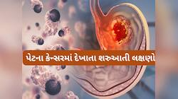 Stomach Cancer: સવારે ઉઠતા વેંત થતી આ 5 સમસ્યા હોય શકે છે પેટમાં કેન્સરની શરુઆત
