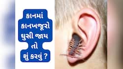 Kankhajura: કાનમાં ઘુસેલા કાનખજૂરાને બહાર કાઢવાના 5 દેશી જુગાડ