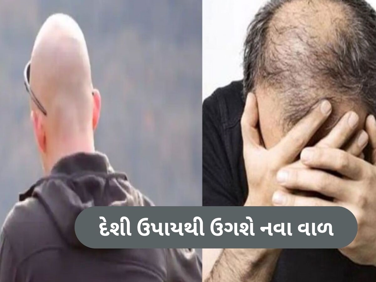 ટાલમાં ઉગી જશે નવા વાળ! બસ અપનાવો આ 3 ઘરેલું ઉપાય, ફટાફટ થશે હેર ગ્રોથ ટાલમાં ઉગી જશે નવા વાળ! બસ અપનાવો આ 3 ઘરેલું ઉપાય, ફટાફટ થશે હેર ગ્રોથ