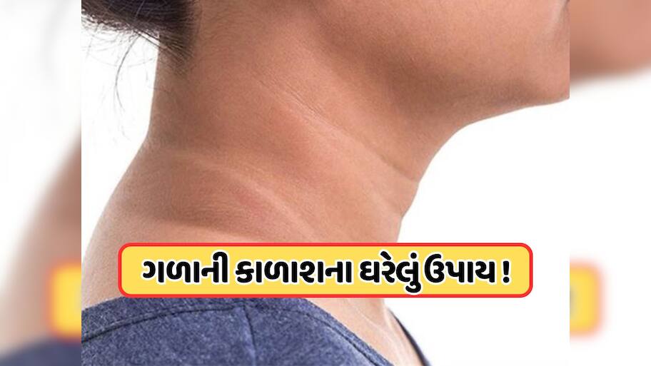 ગળા પરથી કાળાશ દૂર કરવાના ઘરેલું ઉપાય, ફક્ત 2 રૂપિયામાં ટેનિંગ થઈ જશે ગાયબ !