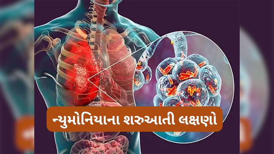 Pneumonia:  જીવલેણ ન્યુમોનિયાના શરુઆતી લક્ષણો, ઉધરસને સામાન્ય ગણી લાંબા સમય સુધી ઈગ્નોર ન કરો